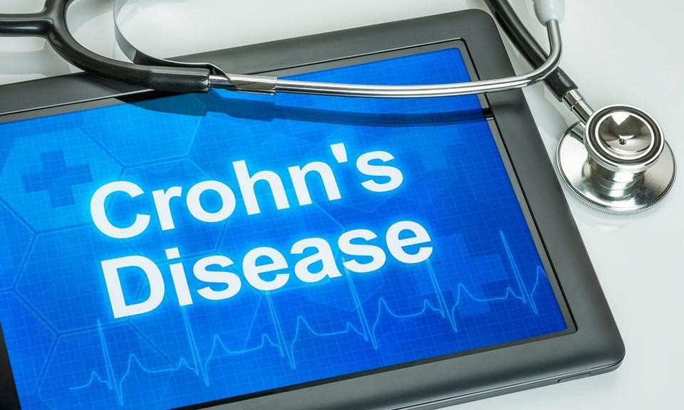 Top 10 Strains to Combat Crohn’s Disease and Colitis
