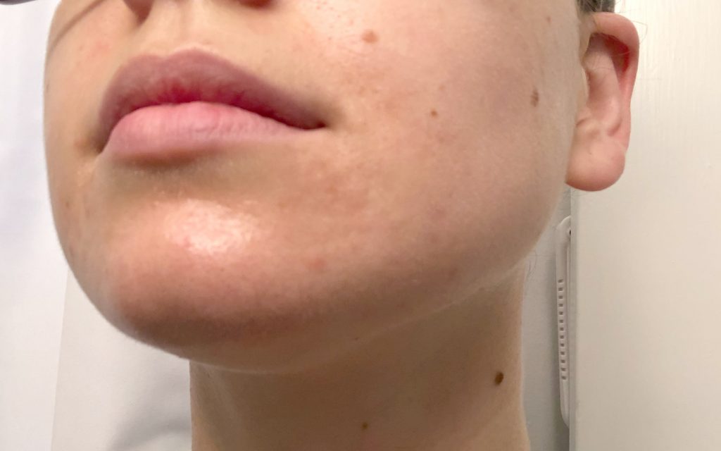 Beautiful skin after applying cannabis topicals for a month.